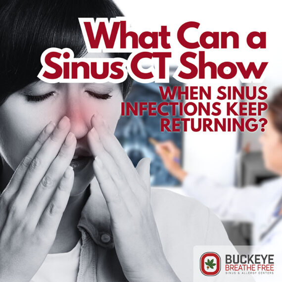 What Can a Sinus CT Show?